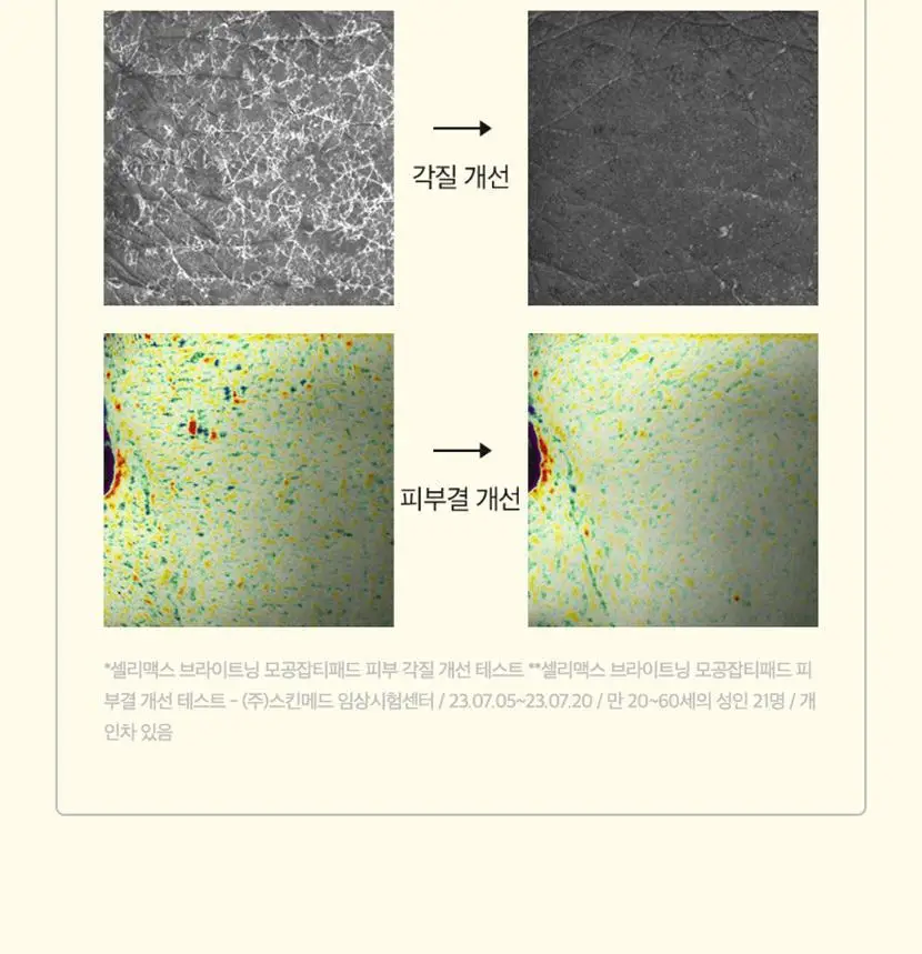 [기현PICK/대용량] 셀리맥스 브라이트닝 모공잡티패드 기획 (80매+20매) 상세페이지 43